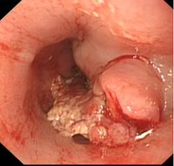 77bf1f4e982284eb32aa257b87ee6b12.jpg clip_image002.jpg