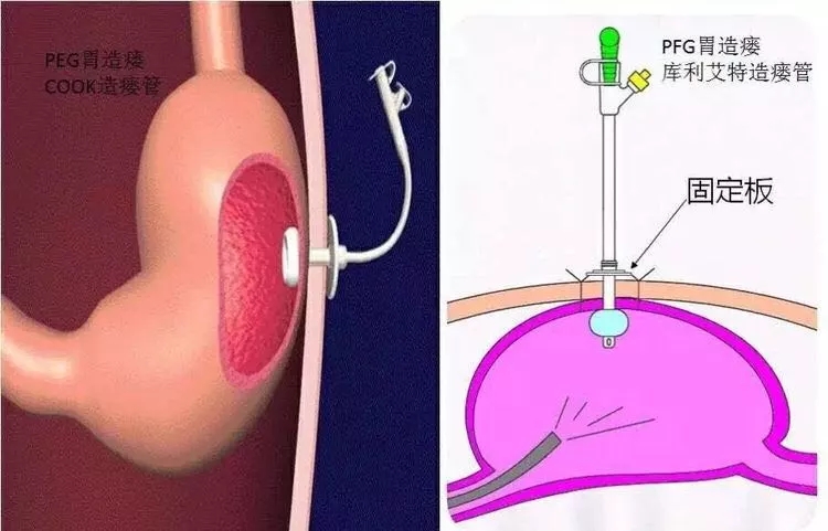 6fb6578d60d8528bd1f05cb15ad7160a.jpg 640.webp (4).jpg