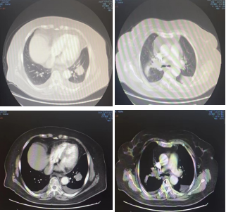 3c695c5378a050eaaf4f7fdbc2ec29b3.png 微信图片_20221220083936.png