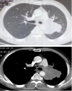 9f5d8509e00bfb18d9e41a268cf76f0c.png 微信图片_20221220083936.png