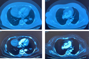 ab151c917bc55c6cd36cc6ef6c8be701.png 微信图片_20221220083936.png