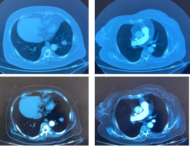 cb09ea09b081401f1110c3eb6cb0d730.png 微信图片_20221220083936.png